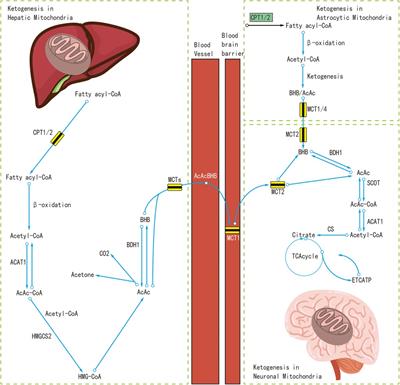 Ketogenic diets therapy in the management of epileptic spasms syndrome